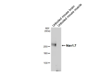 Anti-Nav1.7 antibody [GT434] used in Western Blot (WB). GTX649343
