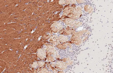 Anti-Nav1.7 antibody [GT434] used in IHC (Paraffin sections) (IHC-P). GTX649343