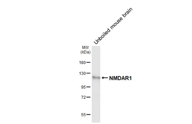 Anti-NMDAR1 antibody [GT435] used in Western Blot (WB). GTX649344