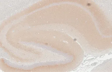 Anti-NMDAR1 antibody [GT435] used in IHC (Paraffin sections) (IHC-P). GTX649344