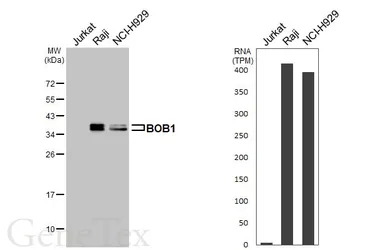 Anti-BOB1 antibody [HL6639] used in Western Blot (WB). GTX649348