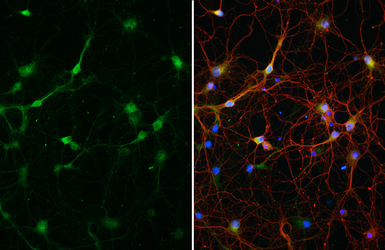 Anti-Neurogranin antibody [HL6640] used in Immunocytochemistry/ Immunofluorescence (ICC/IF). GTX649349