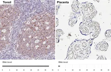 Anti-P2Y8 antibody [HL6649] used in IHC (Paraffin sections) (IHC-P). GTX649358