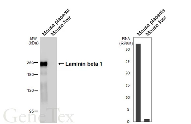 Anti-Laminin beta 1 antibody [HL6655] used in Western Blot (WB). GTX649364