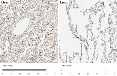 Anti-MRP2 antibody [HL6657] used in IHC (Paraffin sections) (IHC-P). GTX649366
