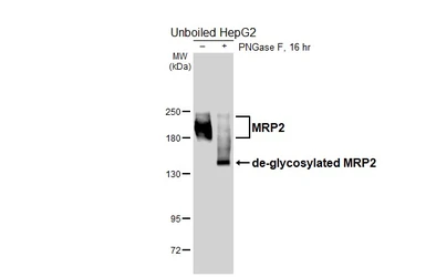 Anti-MRP2 antibody [HL6658] used in Western Blot (WB). GTX649367