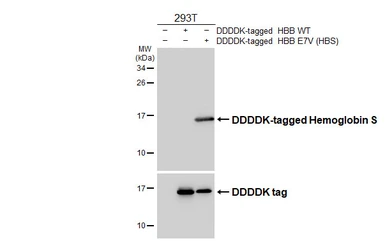 Anti-Hemoglobin S antibody [HL6668] used in Western Blot (WB). GTX649377