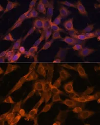 Anti-RAB21 antibody used in Immunocytochemistry/ Immunofluorescence (ICC/IF). GTX64938
