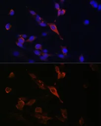 Anti-RAB21 antibody used in Immunocytochemistry/ Immunofluorescence (ICC/IF). GTX64938