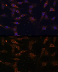 Anti-RAB21 antibody used in Immunocytochemistry/ Immunofluorescence (ICC/IF). GTX64938