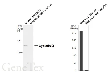 Anti-Cystatin B antibody [HL6675] used in Western Blot (WB). GTX649384
