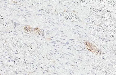 Anti-SNAP25 antibody [HL6680] used in IHC (Paraffin sections) (IHC-P). GTX649391