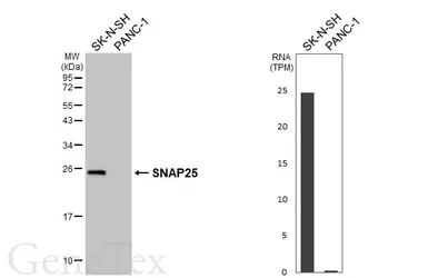 Anti-SNAP25 antibody [HL6681] used in Western Blot (WB). GTX649392