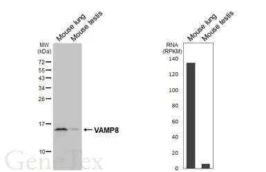 Anti-VAMP8 antibody [HL6688] used in Western Blot (WB). GTX649399