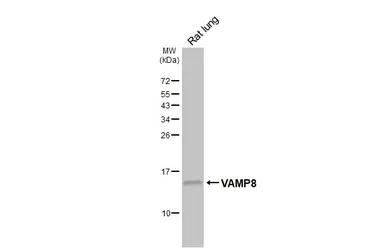 Anti-VAMP8 antibody [HL6688] used in Western Blot (WB). GTX649399