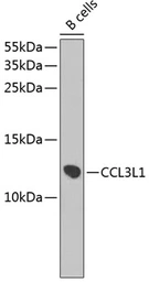 Anti-CCL3L1 antibody used in Western Blot (WB). GTX64940