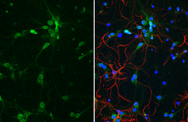 Anti-Parvalbumin antibody [HL6691] used in Immunocytochemistry/ Immunofluorescence (ICC/IF). GTX649402