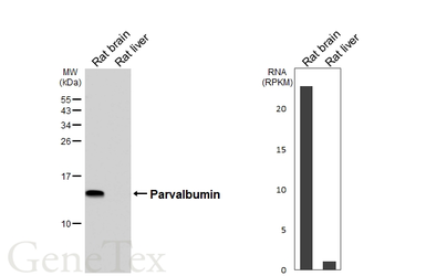 Anti-Parvalbumin antibody [HL6691] used in Western Blot (WB). GTX649402