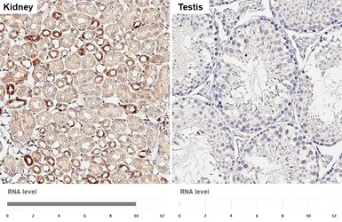 Anti-Parvalbumin antibody [HL6691] used in IHC (Paraffin sections) (IHC-P). GTX649402