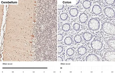 Anti-Parvalbumin antibody [HL6691] used in IHC (Paraffin sections) (IHC-P). GTX649402