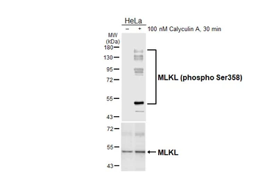 Anti-MLKL (phospho Ser358) antibody [HL6693] used in Western Blot (WB). GTX649404
