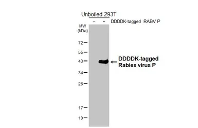 Anti-Rabies virus P antibody [HL6701] used in Western Blot (WB). GTX649412