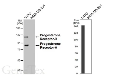 Anti-Progesterone Receptor antibody [HL6704] used in Western Blot (WB). GTX649415