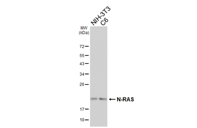Anti-N-RAS antibody [HL6708] used in Western Blot (WB). GTX649419