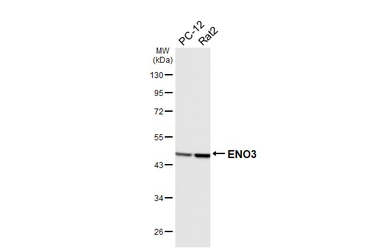 Anti-ENO3 antibody [HL6715] used in Western Blot (WB). GTX649426