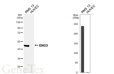 Anti-ENO3 antibody [HL6715] used in Western Blot (WB). GTX649426