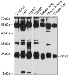 Anti-Syntaxin 8 antibody used in Western Blot (WB). GTX64943