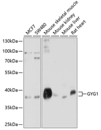 Anti-Glycogenin 1 antibody used in Western Blot (WB). GTX64944
