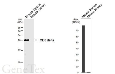 Anti-CD3 delta antibody [GT436] used in Western Blot (WB). GTX649443