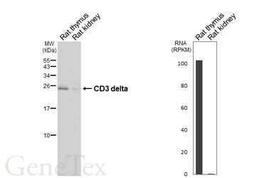 Anti-CD3 delta antibody [GT436] used in Western Blot (WB). GTX649443