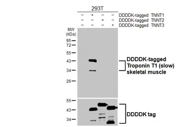 Anti-Troponin T1 (slow) skeletal muscle antibody [HL6725] used in Western Blot (WB). GTX649448