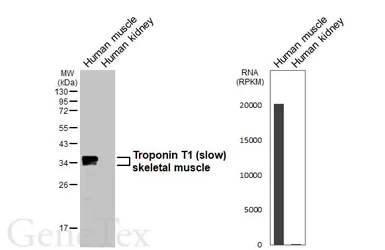 Anti-Troponin T1 (slow) skeletal muscle antibody [HL6725] used in Western Blot (WB). GTX649448