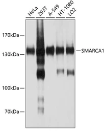 Anti-SMARCA1 antibody used in Western Blot (WB). GTX64945