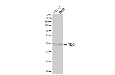 Anti-TDG antibody [HL6733] used in Western Blot (WB). GTX649456