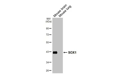 Anti-SOX1 antibody [HL6737] used in Western Blot (WB). GTX649460