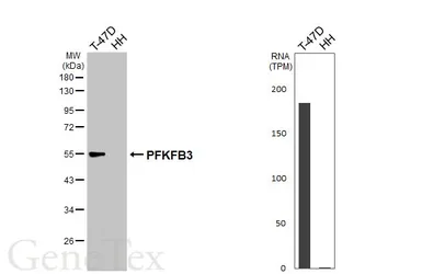 Anti-PFKFB3 antibody [HL6739] used in Western Blot (WB). GTX649462