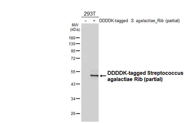 Anti-Streptococcus agalactiae Rib antibody [HL6740] used in Western Blot (WB). GTX649463