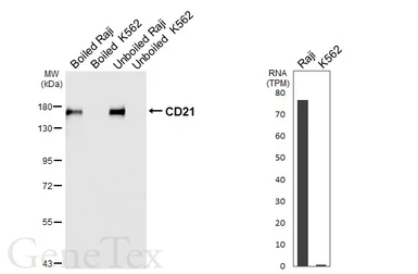 Anti-CD21 antibody [HL6742] used in Western Blot (WB). GTX649465