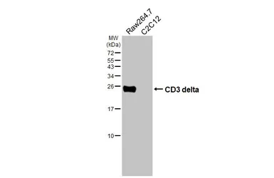 Anti-CD3 delta antibody [HL6744] used in Western Blot (WB). GTX649467