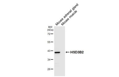 Anti-HSD3B2 antibody [HL6752] used in Western Blot (WB). GTX649475