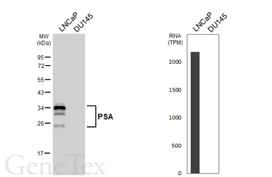Anti-PSA antibody [HL6753] used in Western Blot (WB). GTX649476
