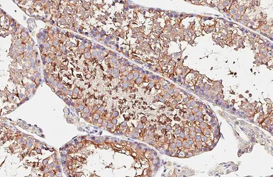 Anti-alpha Tubulin 4a antibody [HL6756] used in IHC (Paraffin sections) (IHC-P). GTX649479
