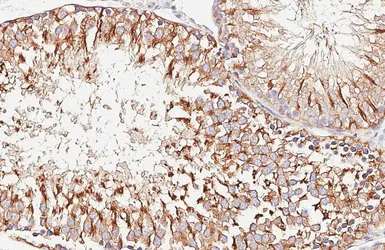 Anti-alpha Tubulin 4a antibody [HL6756] used in IHC (Paraffin sections) (IHC-P). GTX649479