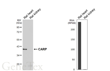 Anti-CARP antibody [GT438] used in Western Blot (WB). GTX649487