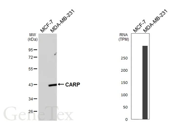 Anti-CARP antibody [GT438] used in Western Blot (WB). GTX649487