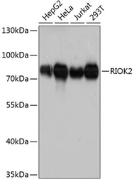 Anti-RIOK2 antibody used in Western Blot (WB). GTX64949
